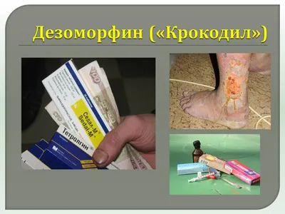 Неделя профилактики употребления наркотических средств » ГБУЗ РБ  Стерлибашевская ЦРБ
