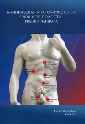 Послеоперационная вентральная грыжа - удалить в СПб | Клиника МедПросвет