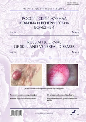 Лечение трихофитии (дерматофитии) в Киеве — Derma.ua