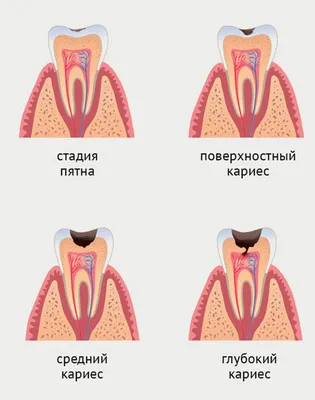 Строение и заболевания зубов