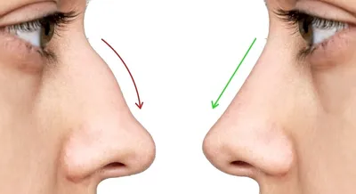 ТОП-10+ лучших клиник для проведения повторной ринопластики в 2023 ▷ цены,  врачи, отзывы | Bookimed