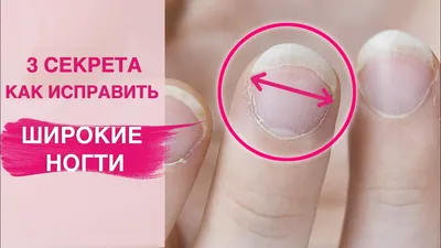 ✓Правильная форма ногтей на ногах | Medped.ru | Дзен