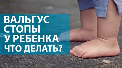 Этапы развития стопы ребёнка.