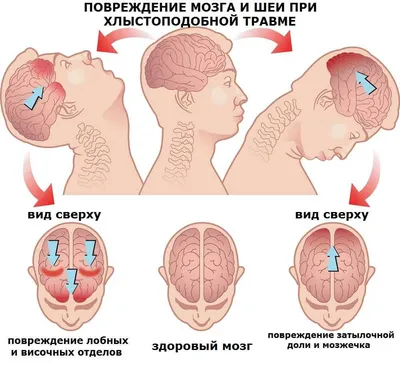 Дима-ДЦП | Тренировка домашняя ДЦП-ПРАВОСТОРОННИЙ гемипарез Аб Дуэр Твист -  Тренажер (Ab Doer Twist) #дцп #дцпдети #качалка #мотивацияспорт | Дзен