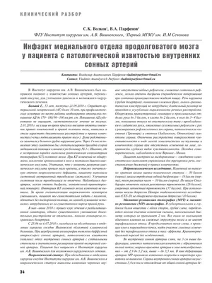 Клинический пример №62. Объёмное образование в области базальных ядер  слева. Правосторонний гемипарез. - Федеральный центр нейрохирургии, г.  Новосибирск