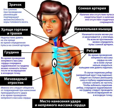 Правила оказания первой помощи: инфаркт, переломы, отравления, остановка  сердца: Уход за собой: Забота о себе: Lenta.ru