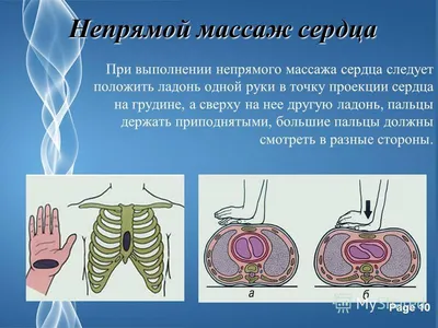 Массаж точек для зрения - Школа мастеров массажа