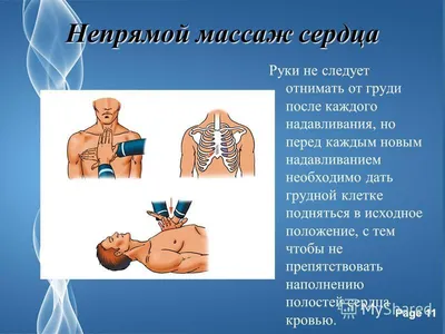 Лечебный массаж - от 1530 руб. — Акции — Медицинский центр «Таурас-Мед»