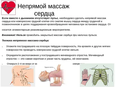 Как делать искусственное дыхание и непрямой массаж сердца: курсы первой  помощи