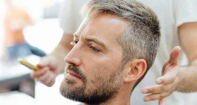 Прически для лысеющих мужчин: 16 фото идей мужских стрижек