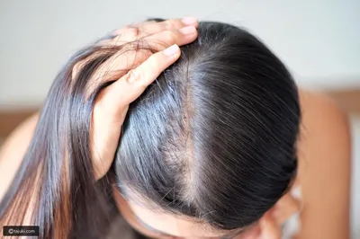 Почему выпадают волосы — блог медицинского центра ОН Клиник