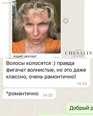 Врач-токсиколог Md.PhD Israel on Instagram: \"САМОДИАГНОСТИКА: ВОЛОСЫ И  НОГТИ ⠀ Прежде, чем пациент обратится к врачу, он может самостоятельно  поставить диагноз. При любой патологии всегда существуют предвестники:  потливость, жажда, усталость ...