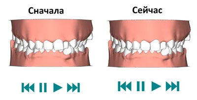 ОРТОДОНТИЯ (исправление прикуса): брекеты, капы, ретейнеры - Dental Practice