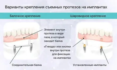 Исправление прикуса любой сложности