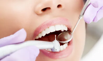 Лечение зубов в сети клиник «Лёгкая стоматология»