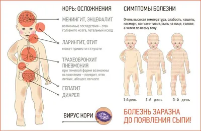 Педиатр из Челябинска рассказала, как корь убивает иммунитет