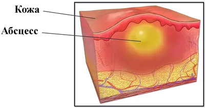 Абсцесс у кошек и котов: признаки и методы лечения нарывов | 3ККК Кошки,  коты и котята | Дзен