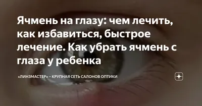 Ячмень на глазу (гордеолум) - причины, симптомы, диагностика и лечение в  Москве