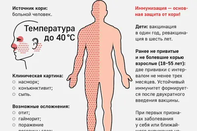 Жителям Волгоградской области рассказали о первых симптомах кори