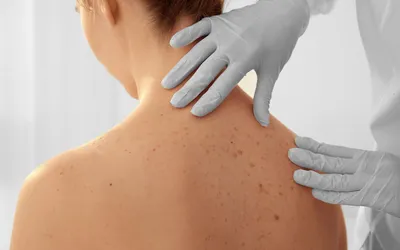 Лечение псориаза: основные методы и способы / Статьи о лечении кожных  заболеваний