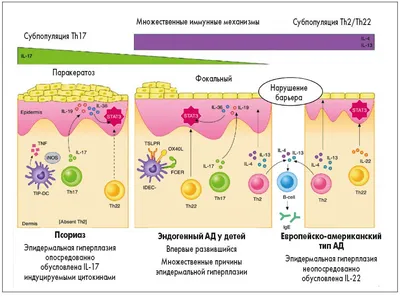 Псориаз - что это такое, причины, как он выглядит, с чего начинается, как  передается у взрослых, чем его вылечить и как избавиться