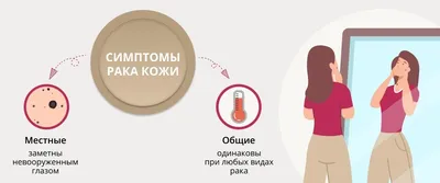 Рак кожи – как он возникает и можно ли вылечить - Феникс