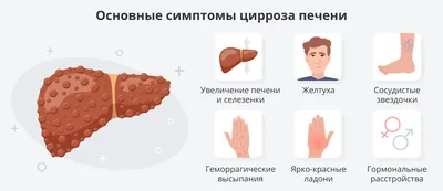 Цирроз печени: симптомы, признаки, методы лечения и препараты