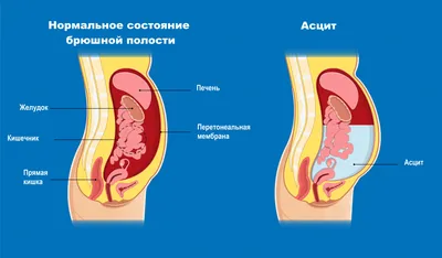 Когда кожа говорит о проблемах с печенью: изменения, которые могут  указывать на её разрушение | Павел Корпачев | Дзен