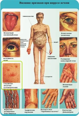 Сигналы «SOS» от печени на коже, или Как вернуть здоровый внешний вид? |  Щотижневик АПТЕКА