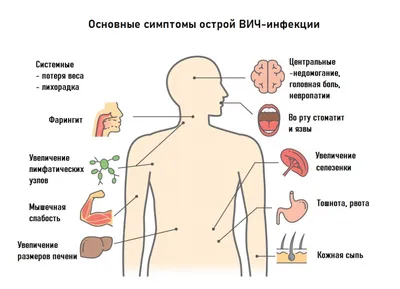 Проявления ВИЧ-инфекции в челюстно-лицевой области у детей