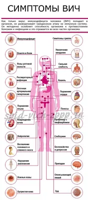 Признаки вич на коже фото фото