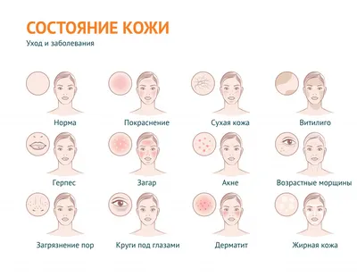 Как ухаживать за проблемной кожей: советы эксперта