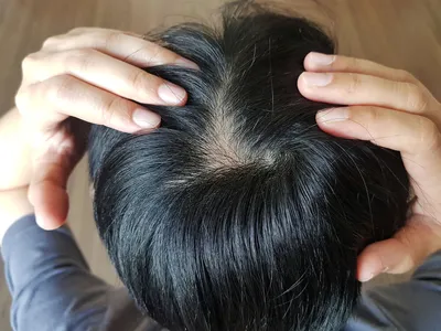 Лечение волос – способы восстановления, симптому болезни волос | Статьи