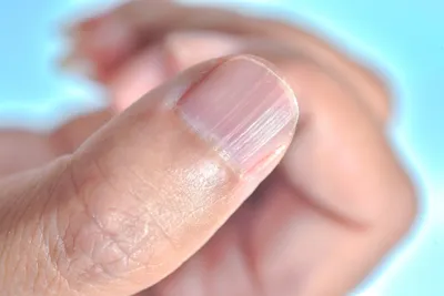 Бороздки на ногтях: причины и правильный уход | ШКОЛА КРАСОТЫ «ИНТЕРИМИДЖ»  | Дзен