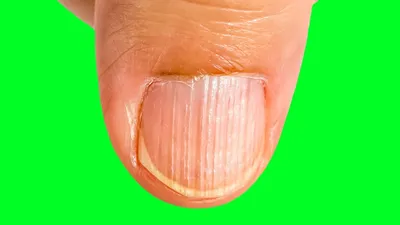 💅 Ногти и чем им помочь ⠀ Здоровые ногти — крепкие, без заусенцев, имеют  гладкую однородную розового цвета пластину без пятен, вкраплений. … |  Instagram