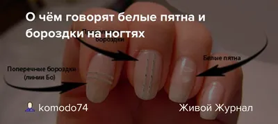 Что за заболевания можно определить по внешнему виду ногтей