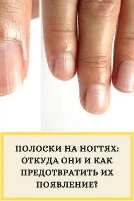 На ногтях вертикальные красные полосы (72 фото) - картинки modnica.club