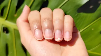 Белые полоски на ногтях рук – причины, что означают | Лечение белых  продольных / поперечных полос в Клинике подологии Полёт