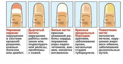 вертикальные полосы на ногтях рук причины фото: 6 тыс изображений найдено в  Яндекс.Картинках | Полосы на ногтях, Советы, Полезные советы