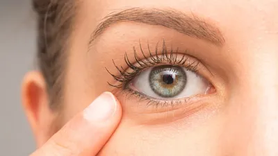 Можно ли использовать ромашку для промывания глаз при конъюнктивите? -  энциклопедия Ochkov.net