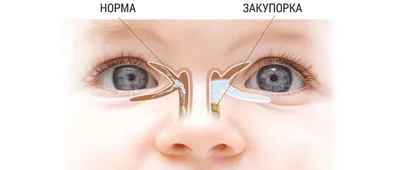 Как правильно промывать глаза: что выбрать для промывания глаз детям