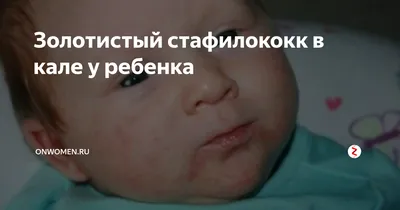 Золотистый стафилококк способствует развитию экземы: новые исследования