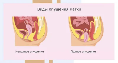 Иллюстрация 1 из 7 для Пролапс тазовых органов у женщин. Пособие для врачей  - Коршунов, Сазыкина |