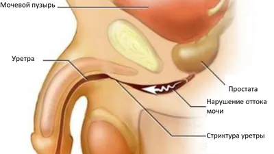 Development of a Uterosacral Ligament Suspension Rat Model | Protocol  (Translated to Russian)