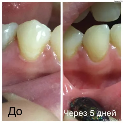 Профилактика образования пролежней. Как не допустить? - полезные статьи от  специалистов - Медицинский центр «АудиоМед»