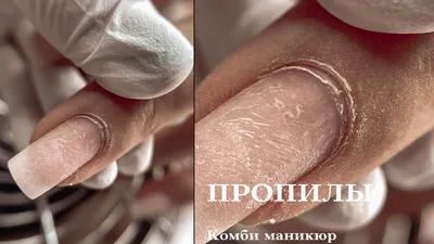 Пропилы ногтевой пластины. Причина, чтобы сменить мастера маникюра |  ВКонтакте