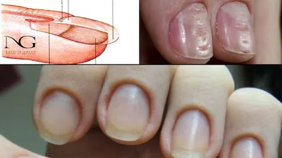 Покалеченные ногти после маникюра 🤯 | VIKOLA beauty | Дзен