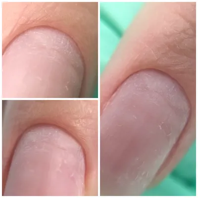 Пропилы на ногтях после аппаратного - 40 фото