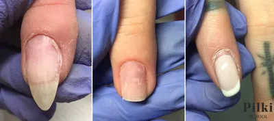 Пропил ногтя при аппаратном маникюре фото фото