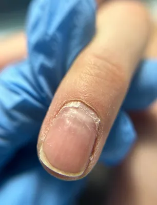 Ужасные пропилы.Как не сделать пропил/Как делать маникюр на ногте с  пропилом - YouTube